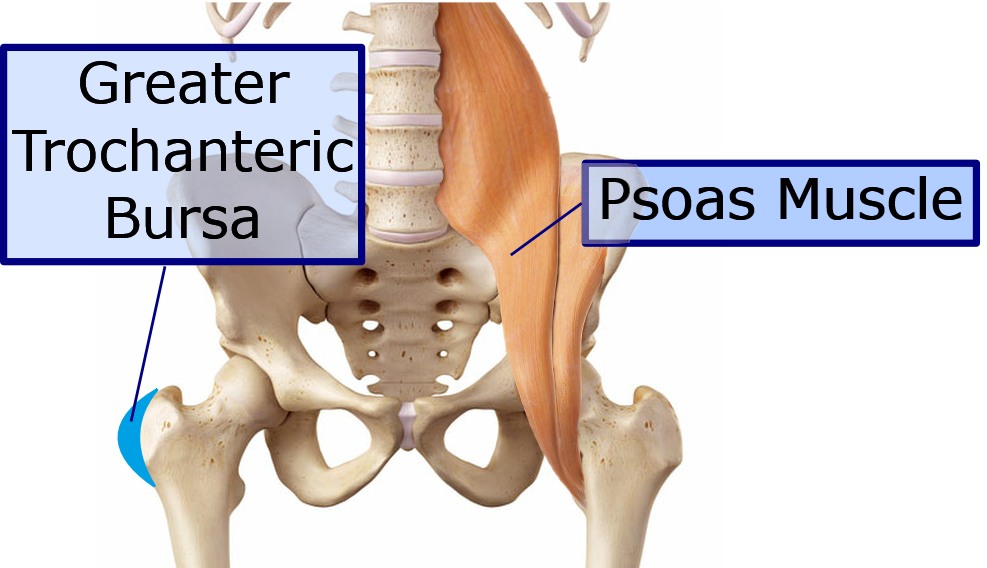 Hip diagram with psoas