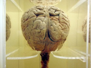 The human brain contains more neurons than any other species