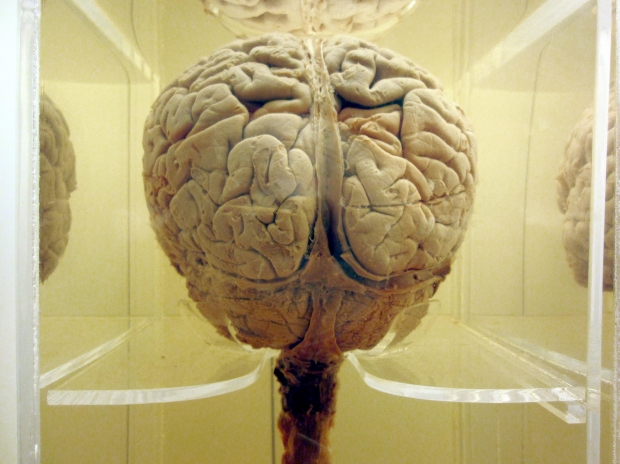 Do We Really Use Just 10% of our Brains?