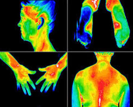 Thermography scans