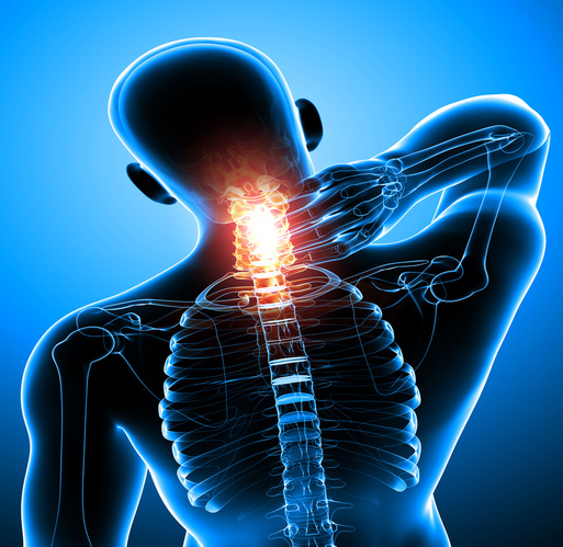 Campbell, CA Chiropractor Neck Pain