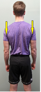 back shrug