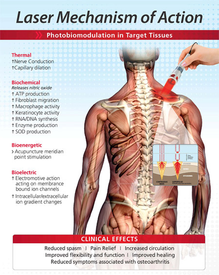 Medical Laser Therapy