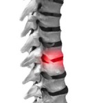 spine