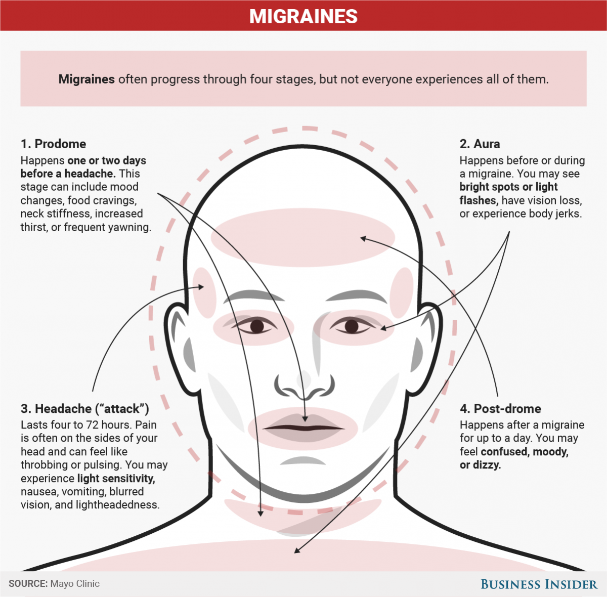 Headaches and Chiropractic care | Chiropractic Centres