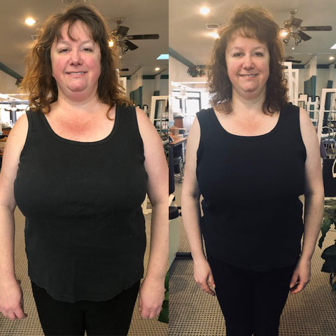 Before & After photo of Elizabeth - Front