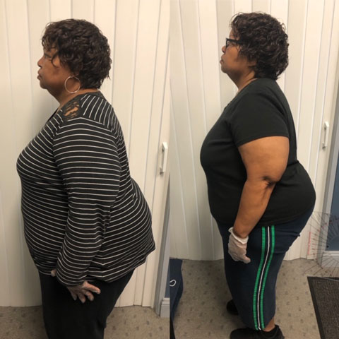 Side view of Dee T. before and after