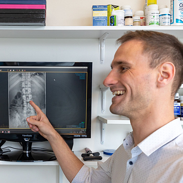chiropractor pointing to xray