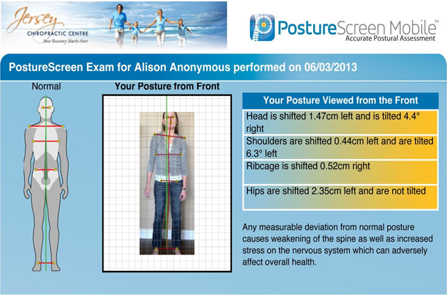 Posture Assesment - Front