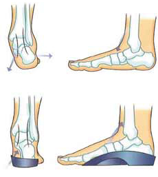 foot illustrations