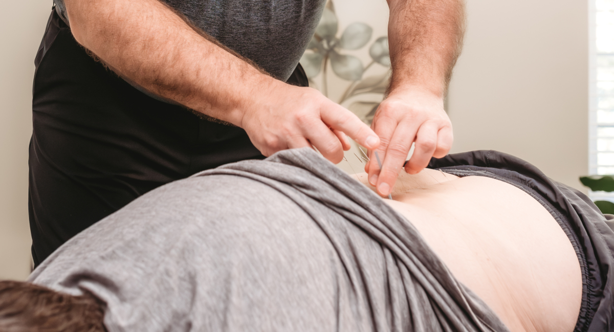Acupuncture used on male patient's lower-back