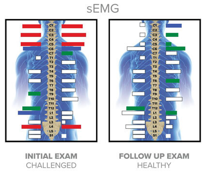 sEMG Scan