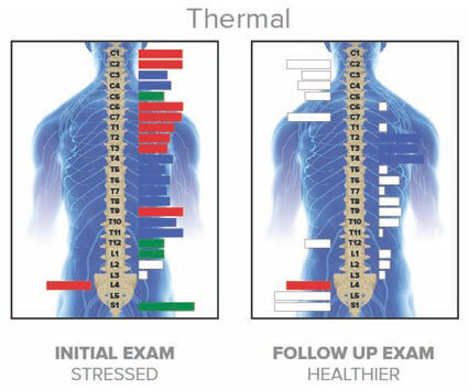 Thermal Scan