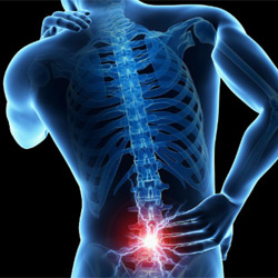 Back Pain Relief at In-Line Family Chiropractic