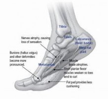 chart of the bones in a foot