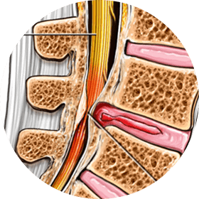 NERVE FUNCTION INTERFERANCE