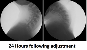 two neck scan xrays