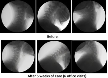 5 weeks of neck scan images