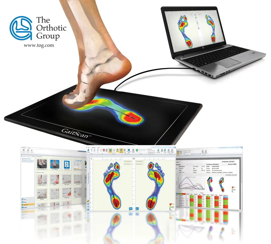 gaitscan illustration
