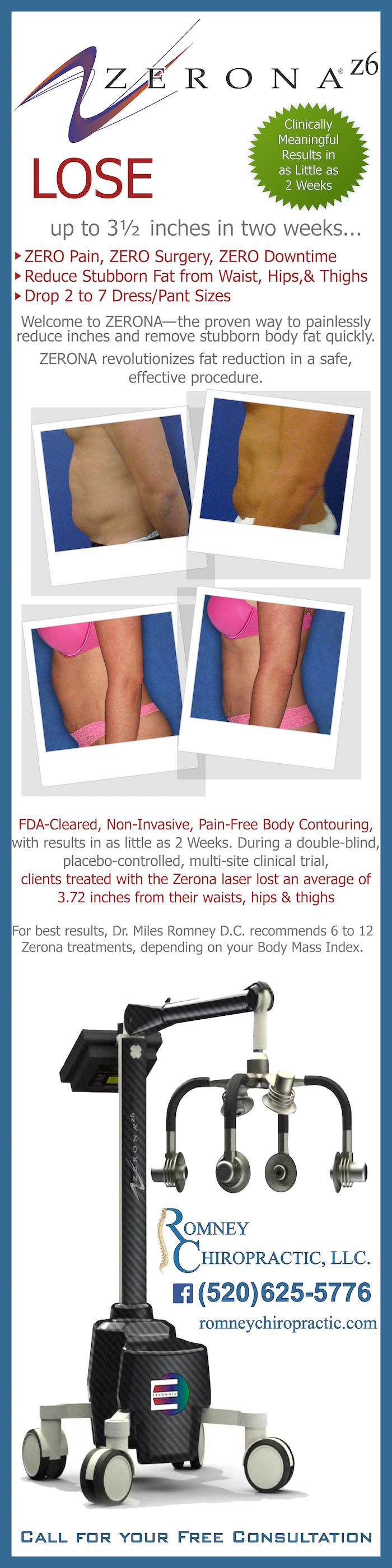 https://doc.vortala.com/childsites/uploads/1621/files/zerona-z6-fat-loss-laser.jpg