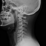 Picture of spine