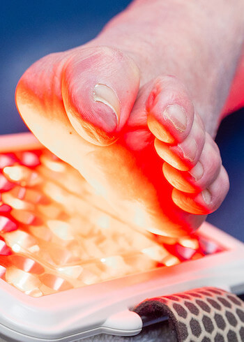 Laser therapy used on feet