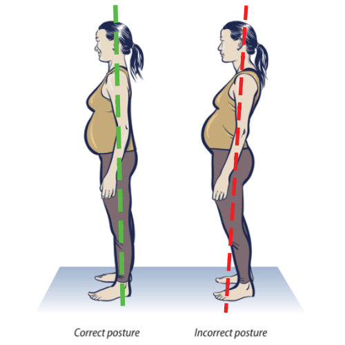 Pregnancy posture