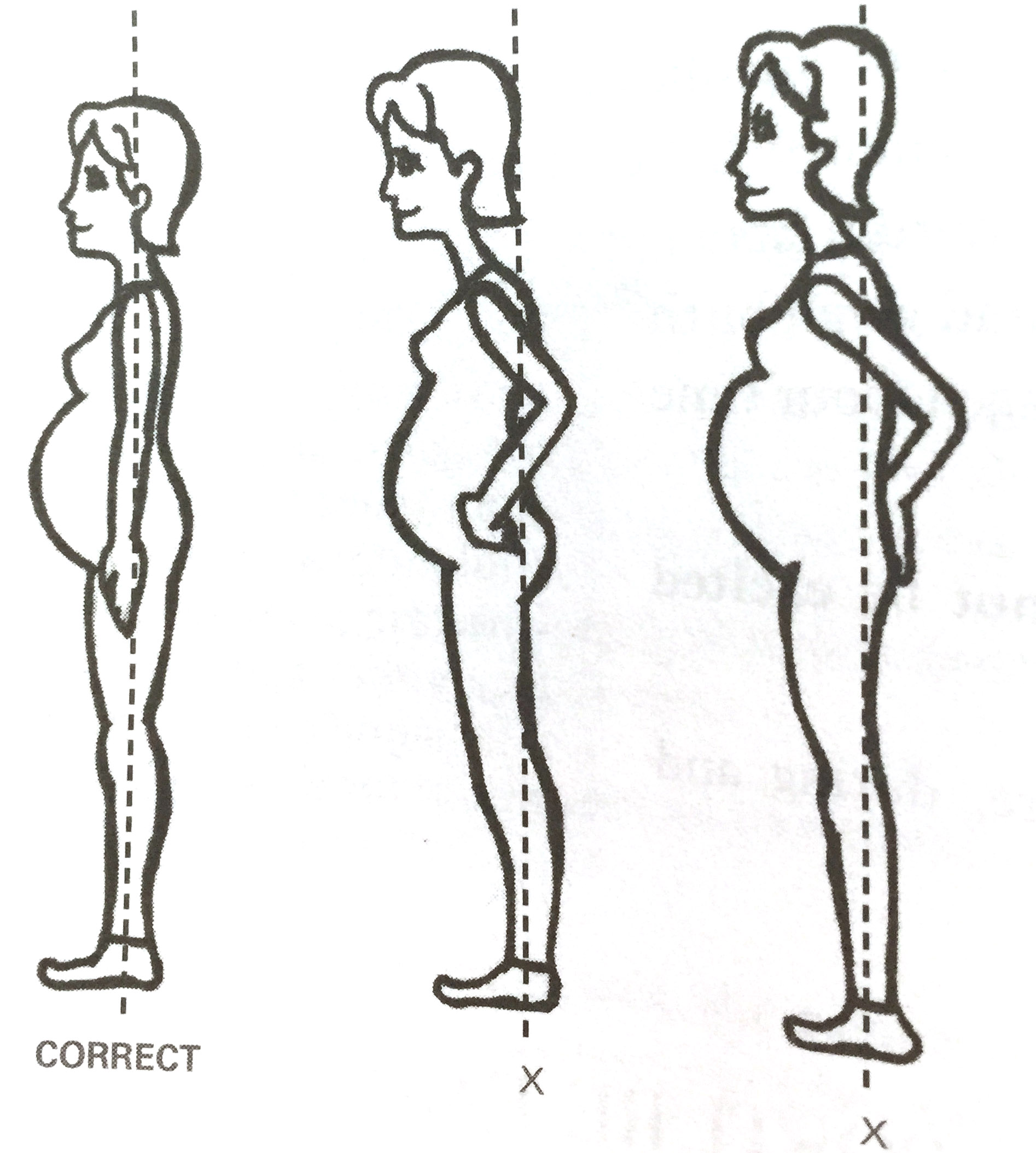 Pregnant Alignment