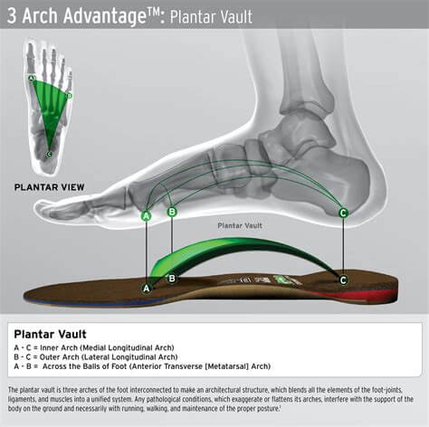 3 arch advantage plantar vault 