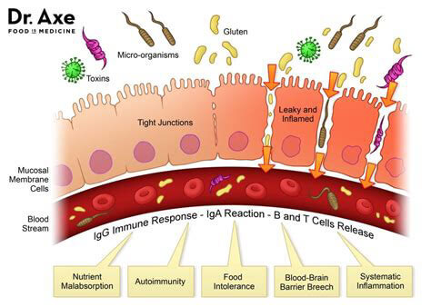 Gut Health Diagram