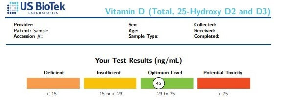 Vitamin D test results