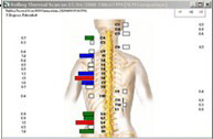 After Neurological Scan After Neurological Scan