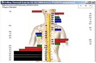 Before Neurological Scan Before Neurological Scan
