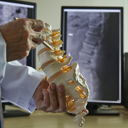 doctor holding a spine and examining x-rays