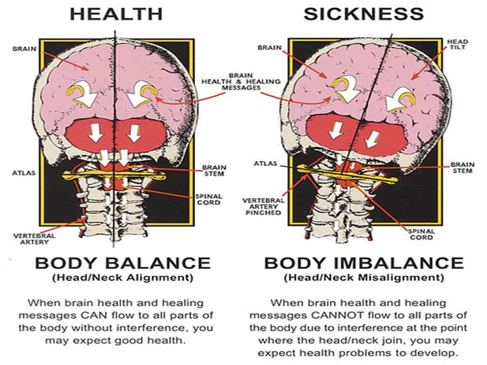 Body Imbalance Illustration