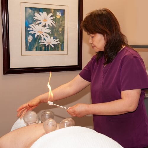 acupuncture needles applied to back