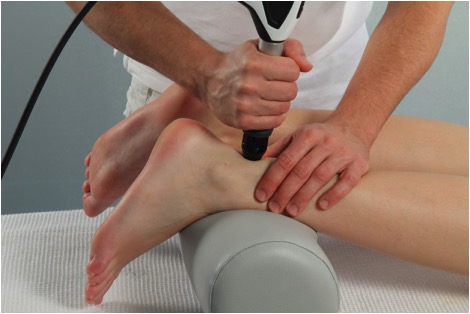 Shock wave therapy hot sale for plantar fasciitis cost