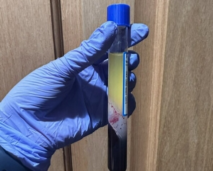 Holding PRP vial