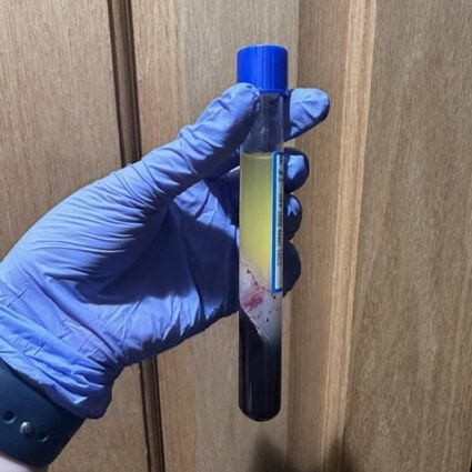 blood sample in vial