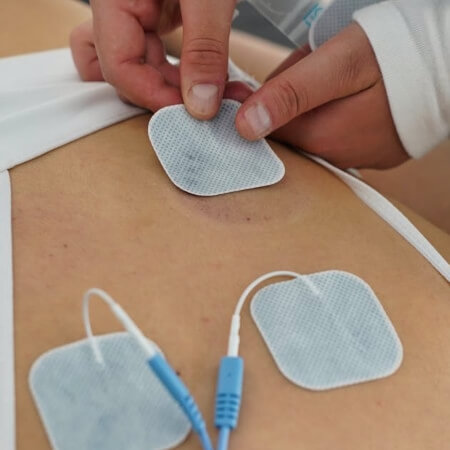 E-Stim therapy used to treat patient