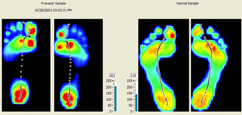 GaitScan Comparison