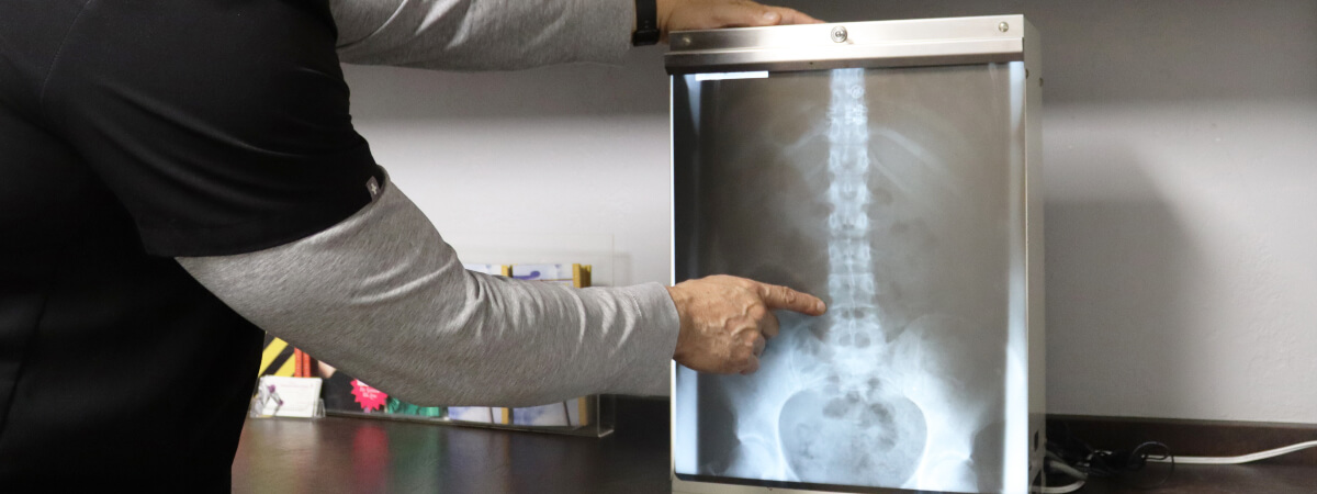 Chiropractor pointing at an x-ray
