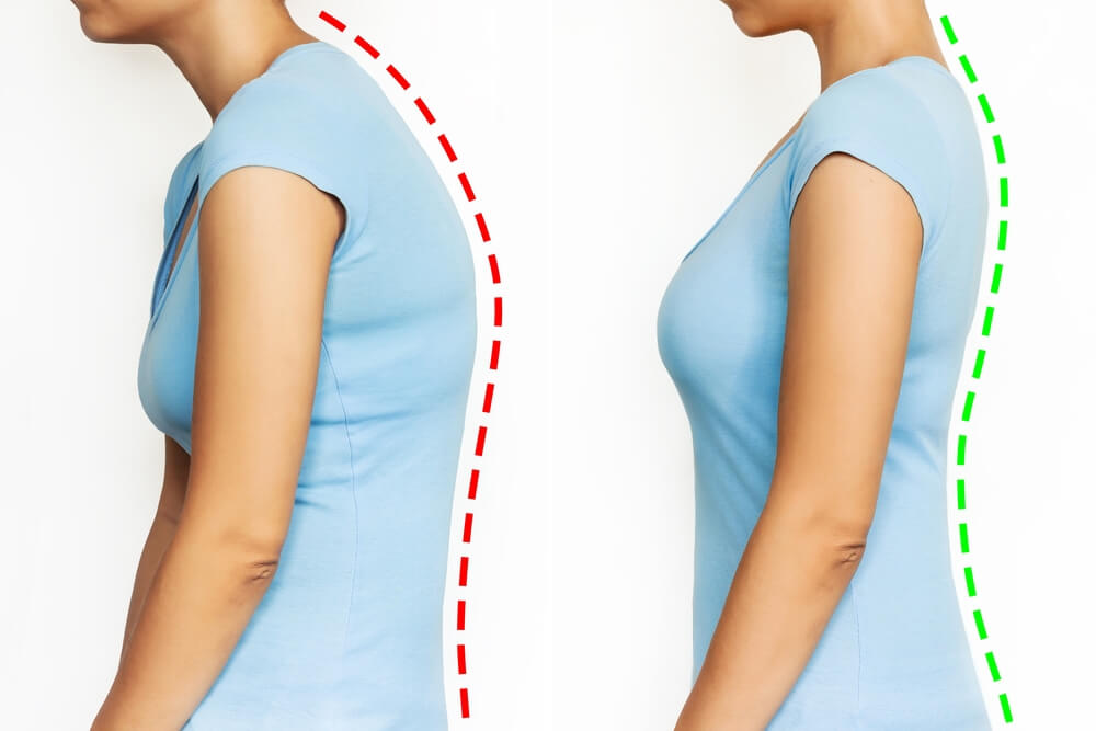 How to fix poor posture with chiropractic care