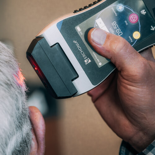 Laser Therapy applied to head