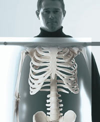 X-ray