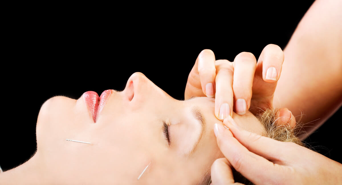 Female patient receiving dry needling therapy on neck