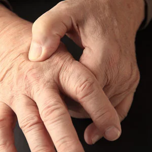 male hands with joint pain