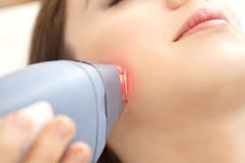 Laser Hair Removal on face