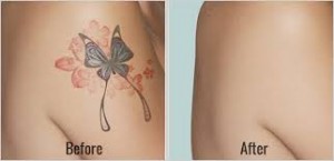Tattoo before and after