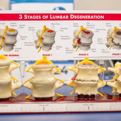 spine model